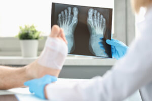 go to urgent care for an x-ray