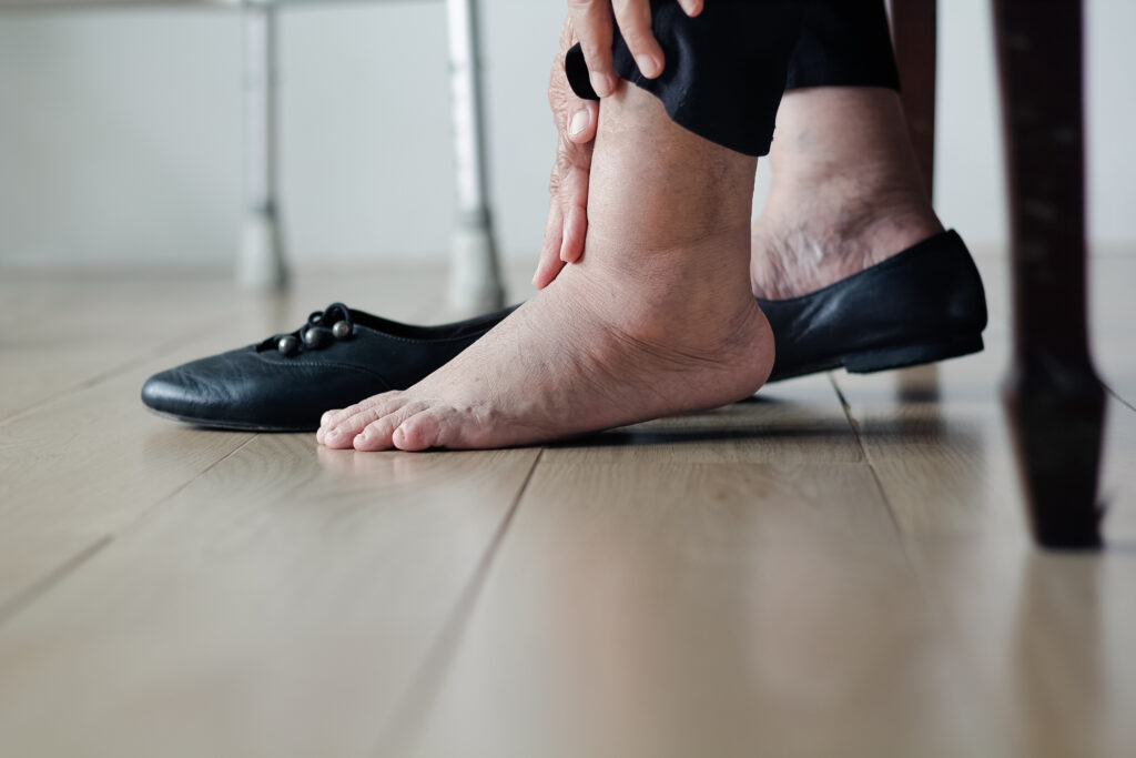 should I go to urgent care for swelling in legs