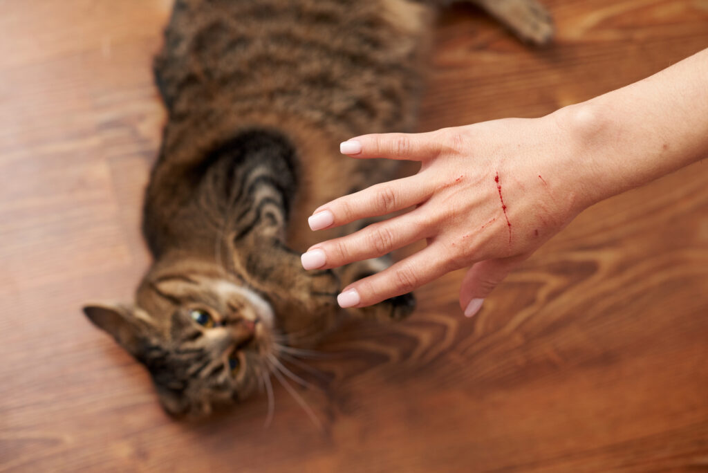 A female hand with a bloody scratch from a cat seen in the background for urgent-care-for-a-pet-scratch blog.