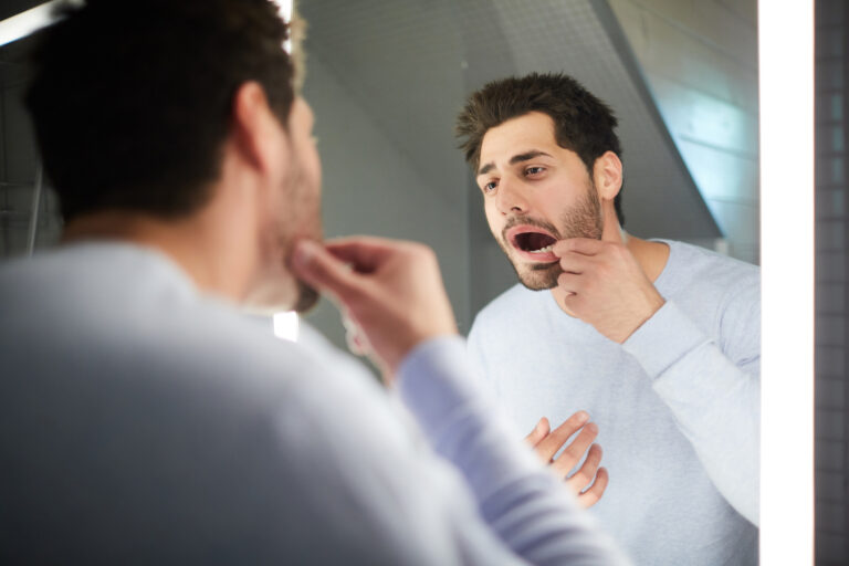 A man inspects his lip in a bathroom mirror for urgent-care-for-severe-cold-sores-or-mouth-ulcers blog.